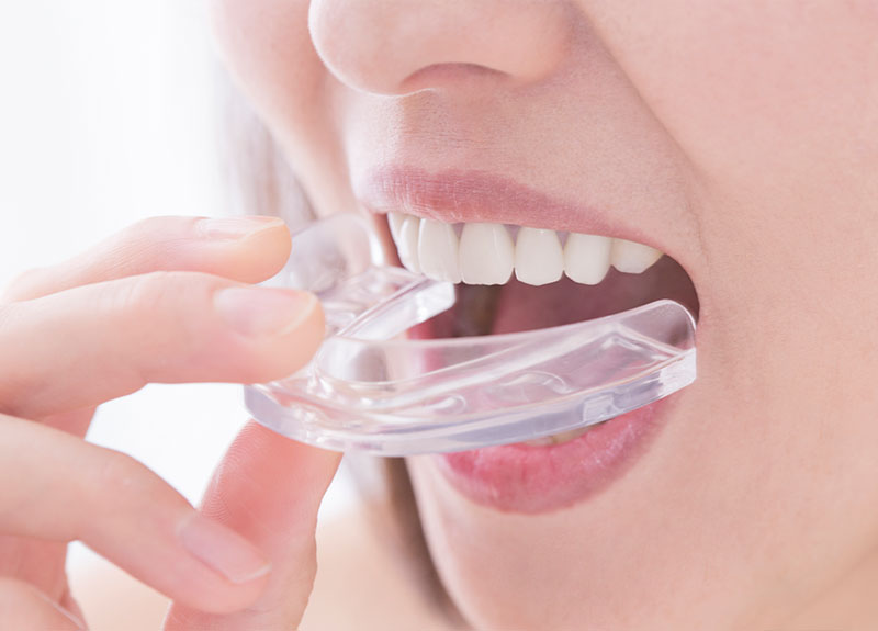 ホワイトニング