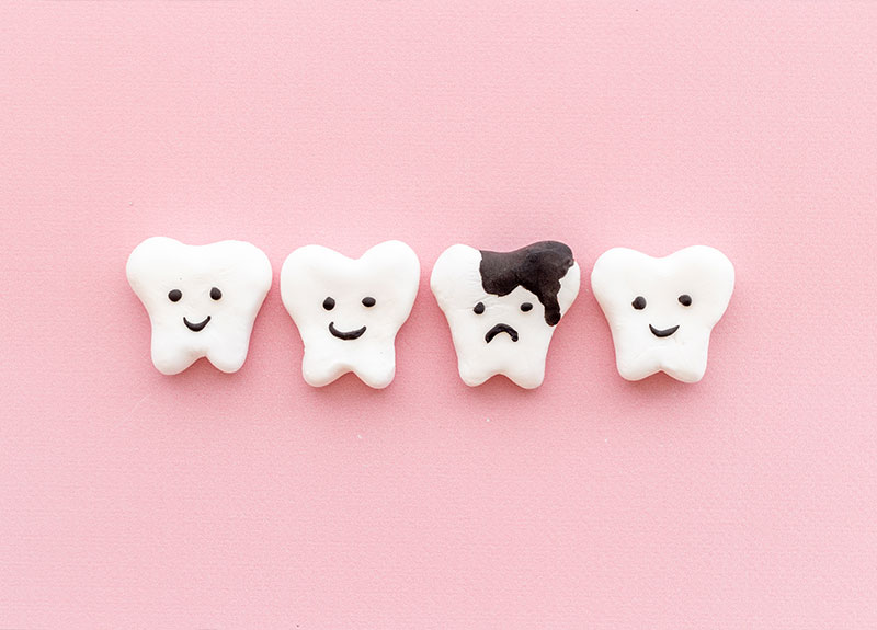 ホワイトニング