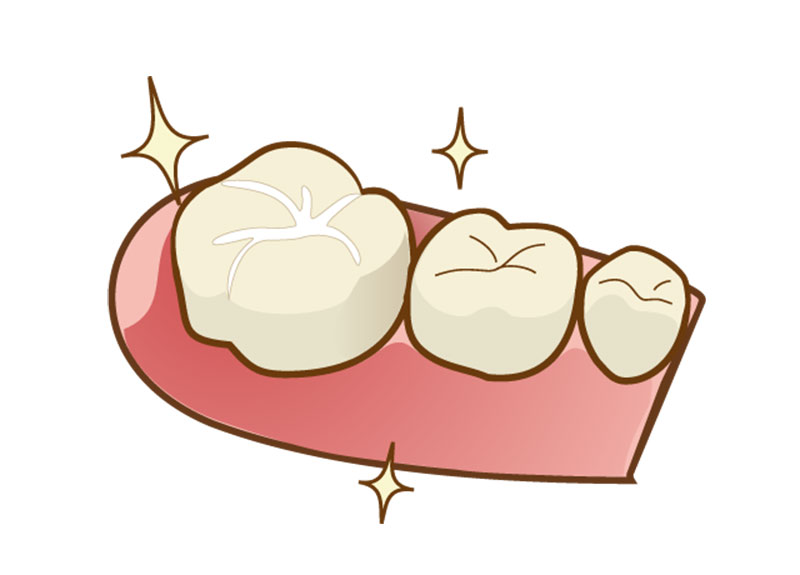 ホワイトニング