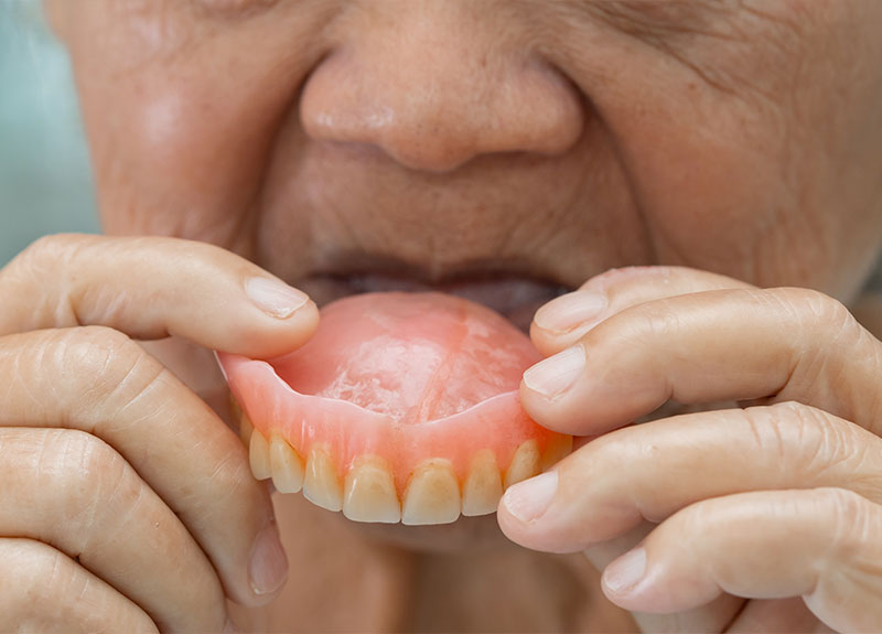 ホワイトニング