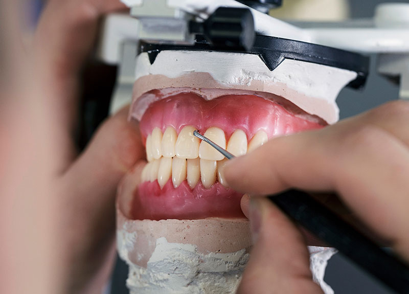 ホワイトニング