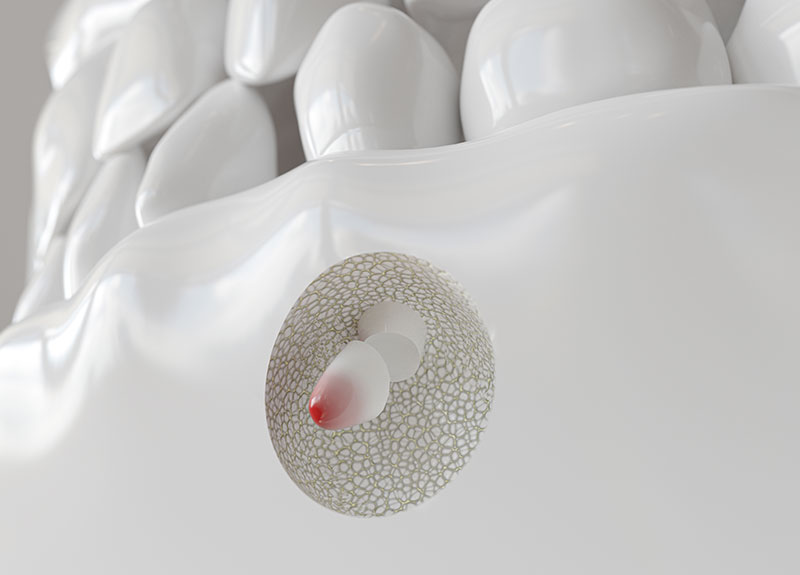 ホワイトニング