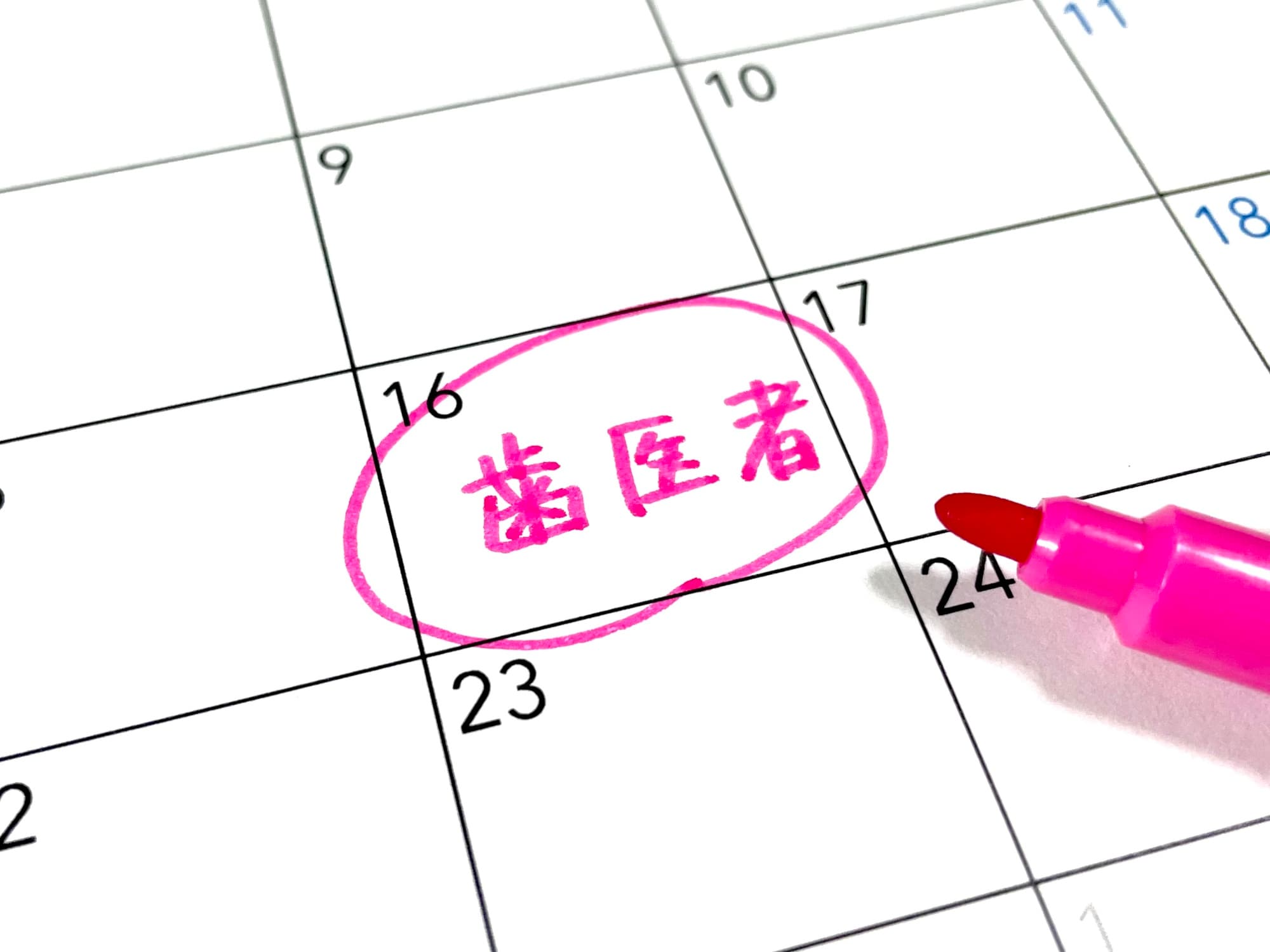 八重歯治療の予定を記入したカレンダー