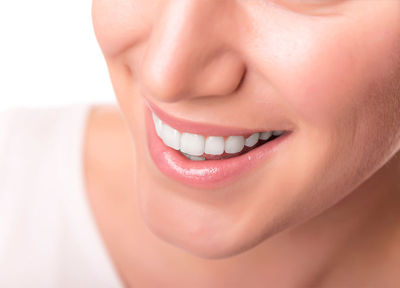 ホワイトニング