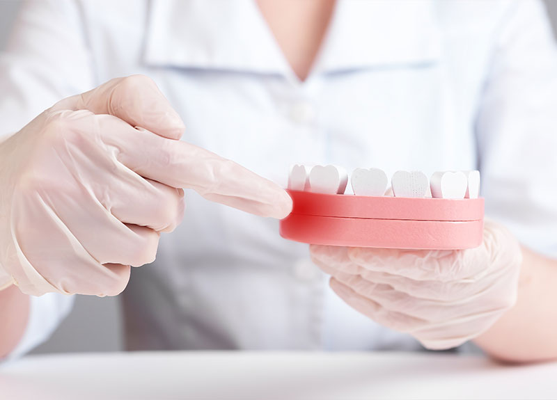 ホワイトニング