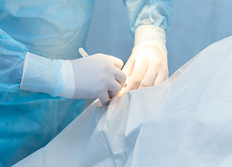 ホワイトニング