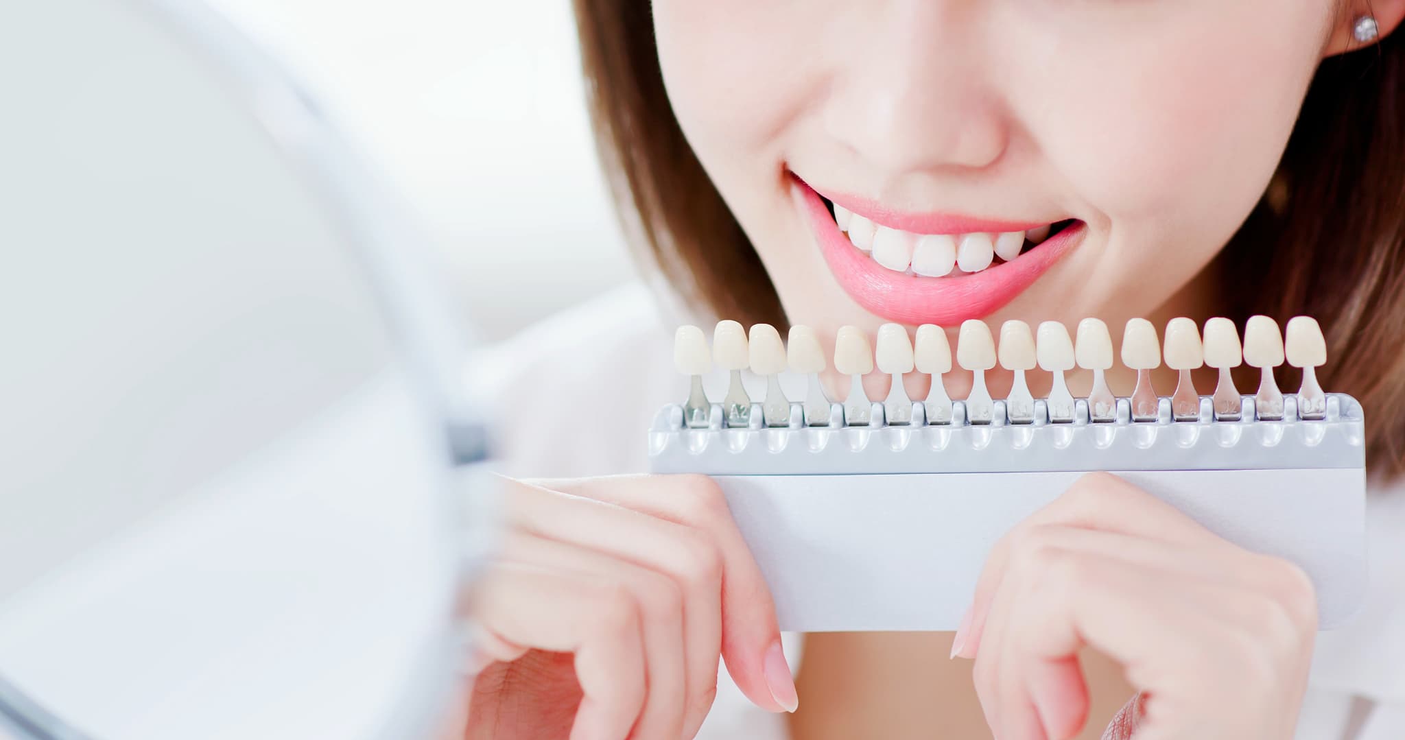 歯の色をシェードガイドで確認する女性
