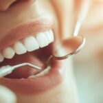 歯のクリーニングを受ける女性の口元