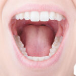 奥歯をセラミックにしたイメージ