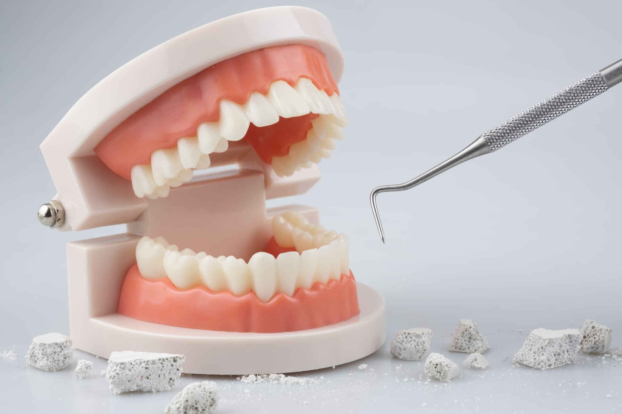 歯石除去のイメージ