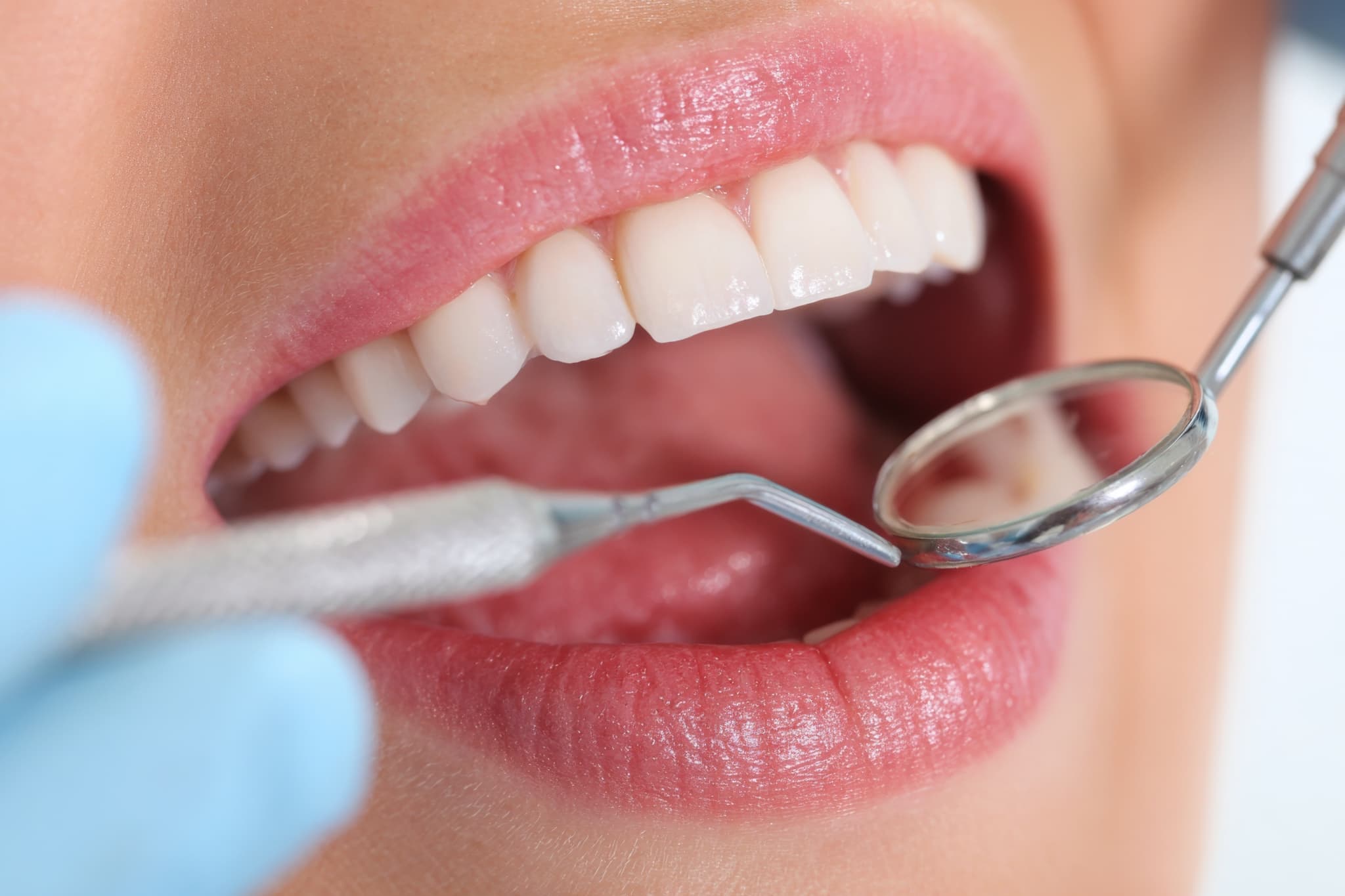 口腔内のチェックを受ける様子