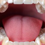 口腔内の筋肉と舌のイメージ