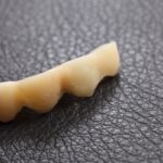 前歯を補う入れ歯